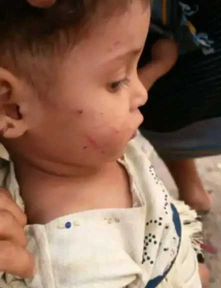 صور مروّعة توثق اعتداء أب على طفله بمحافظة المحويت .. ومطالبات عاجلة بالتدخل وحماية الطفل