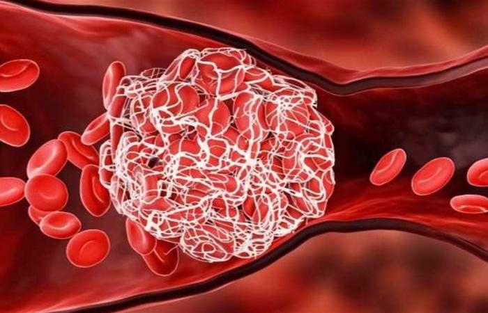 أخبار العالم : دراسة: "مواد كيميائية أبدية" في دماء جميع سكان هولندا تتجاوز الحدود الآمنة