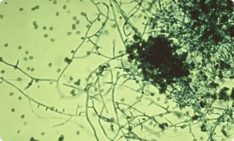 إنجاز علمي مصري: اكتشاف نوع جديد من الفطريات يُسجّل عالميًا باسم "Trichoderma egyptiacum"