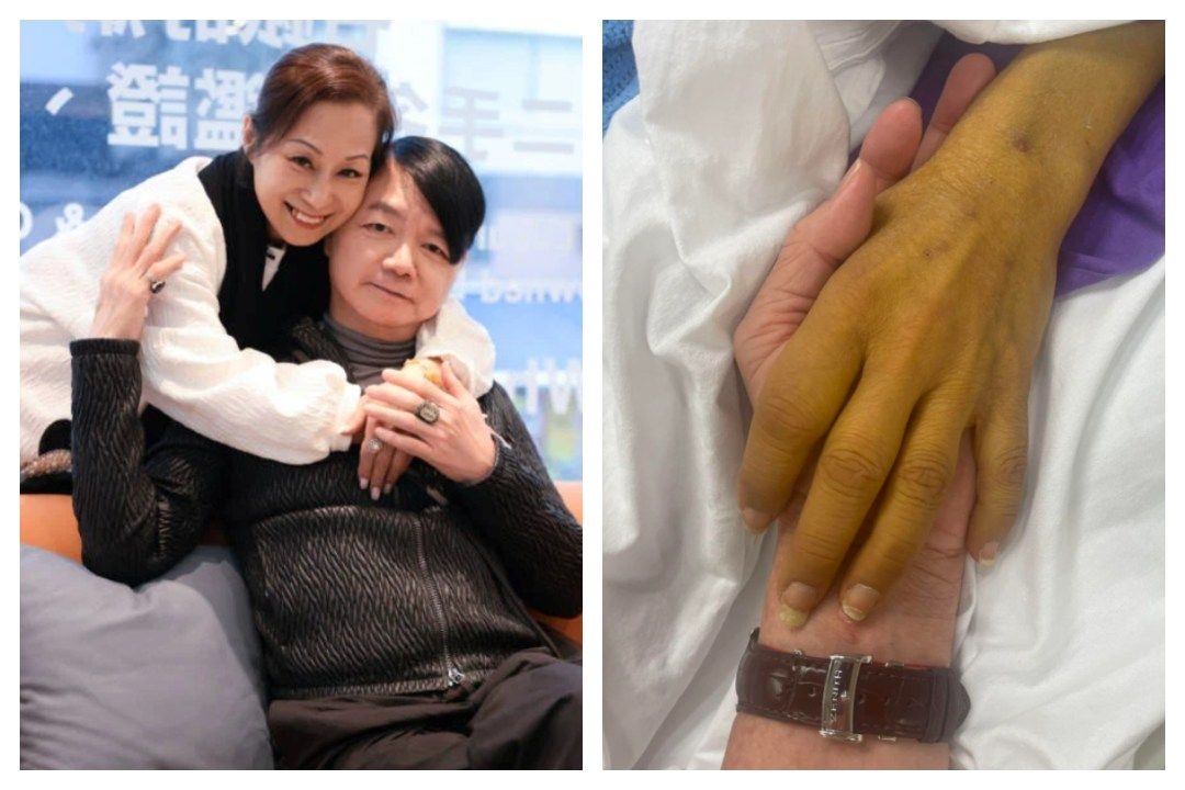 HK actor Ai Wai says wife has died at 61, over a week after plea for liver donor