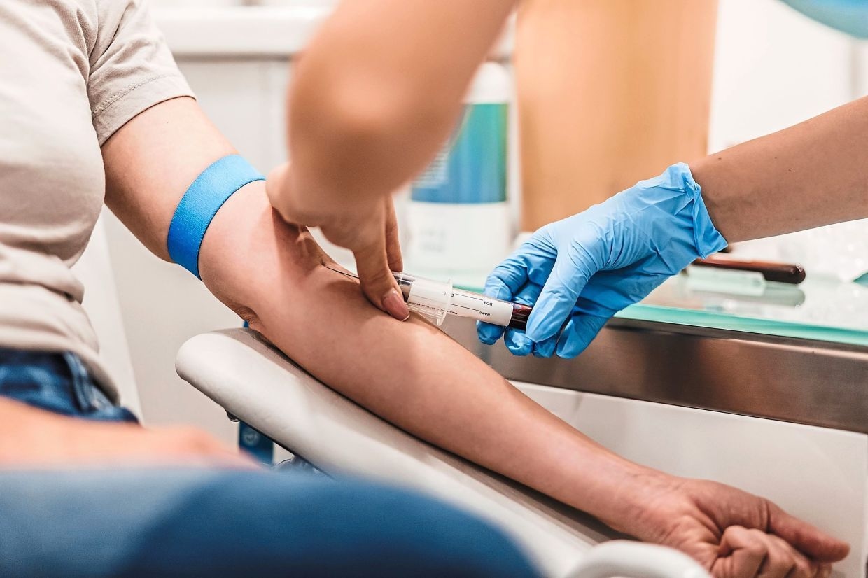 ‘Blood tests preferred for vocational driving licence'