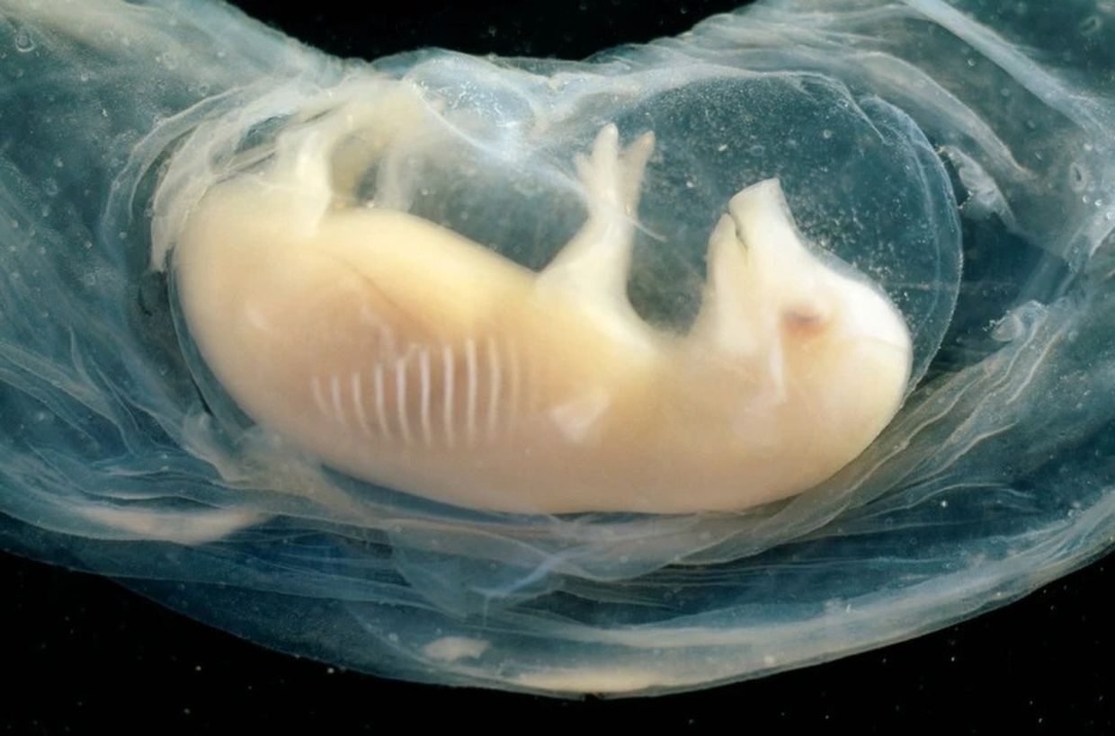Human heart structure beats 21 days in pig embryo in Chinese chimera study