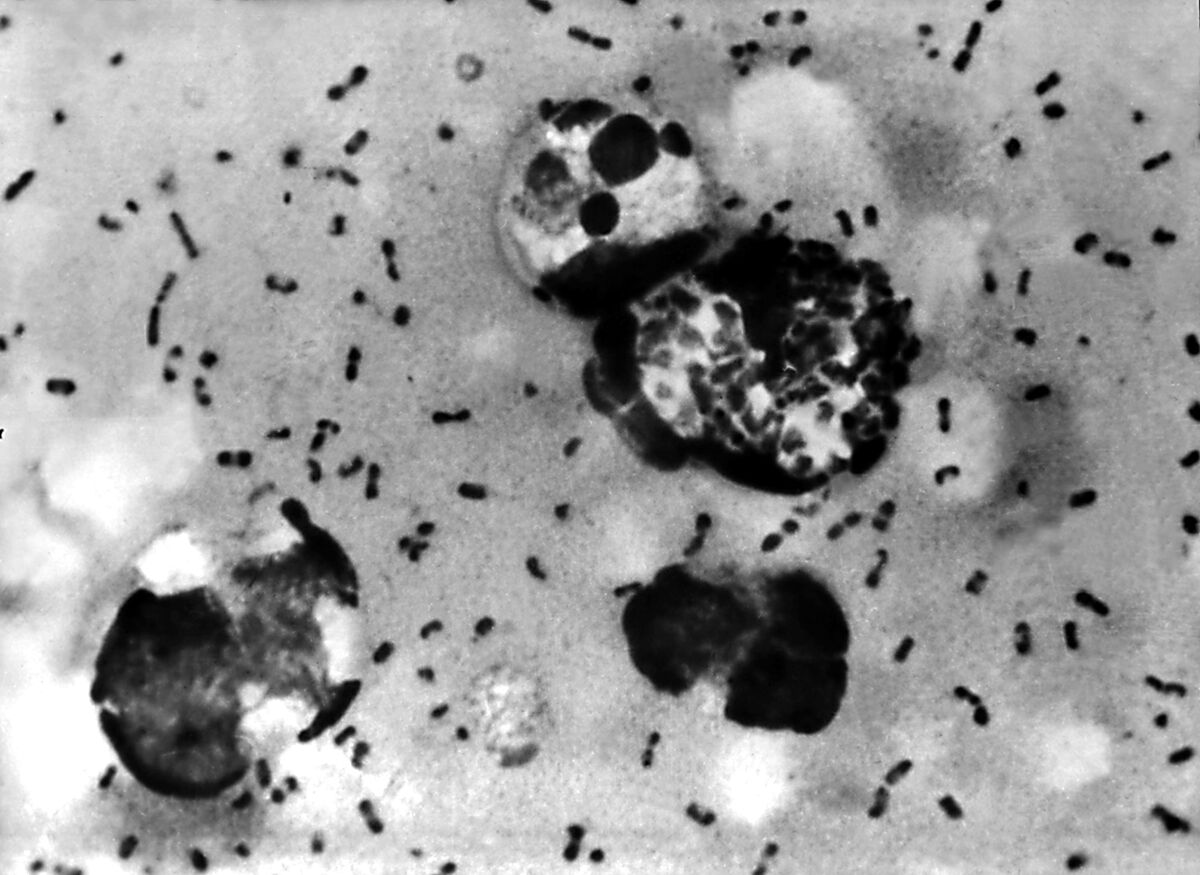 What You Should Know About the Plague After an Arizona Death