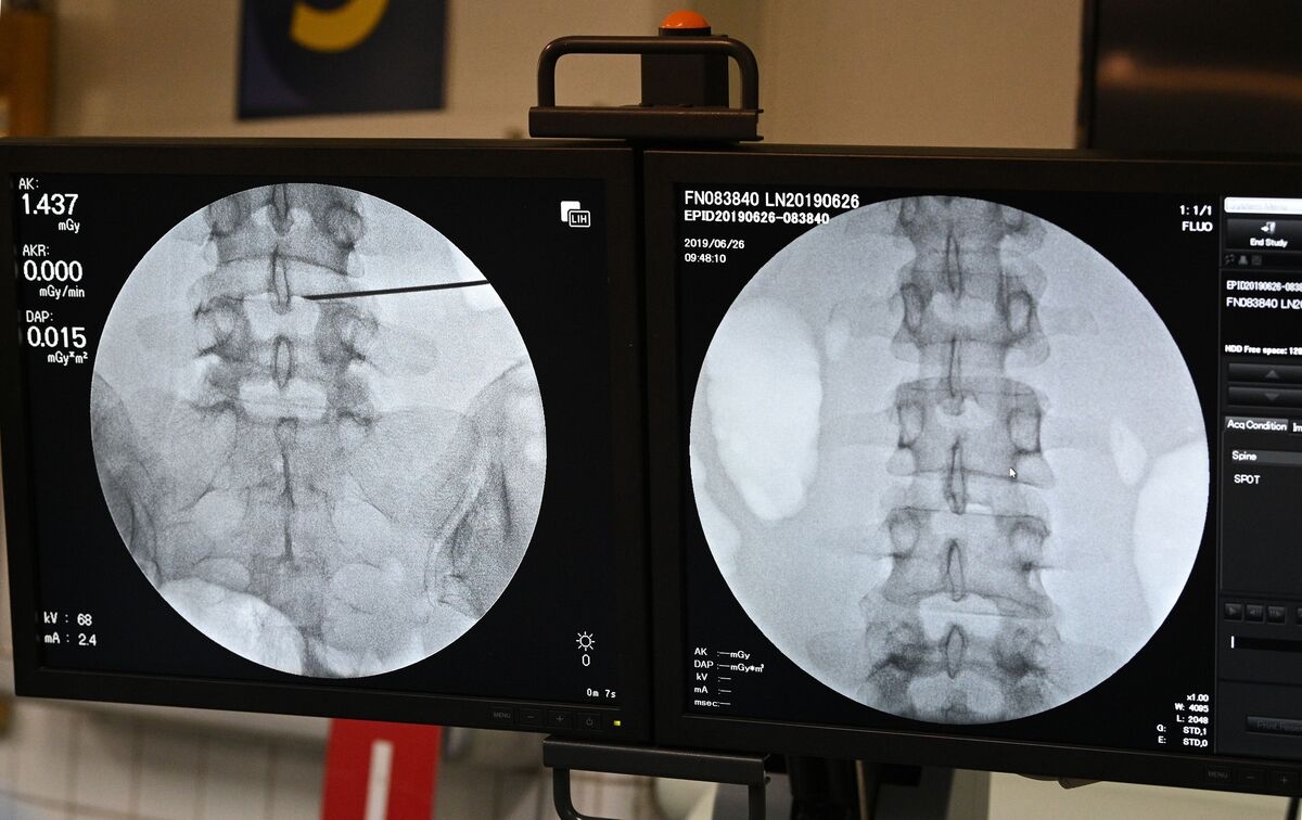 AI Spine Surgery Firm Carlsmed Shares Fall 6.7% After IPO