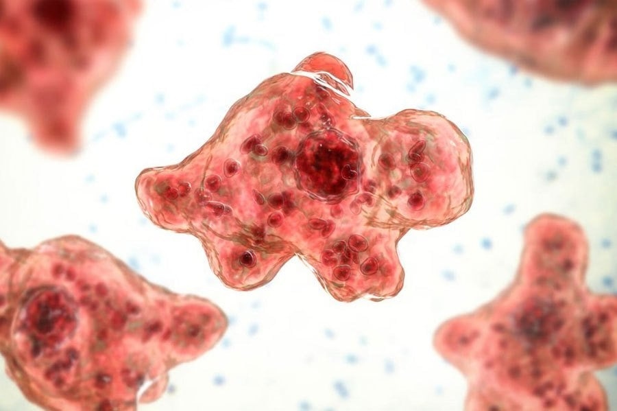 Brain-eating amoeba linked to camper's death