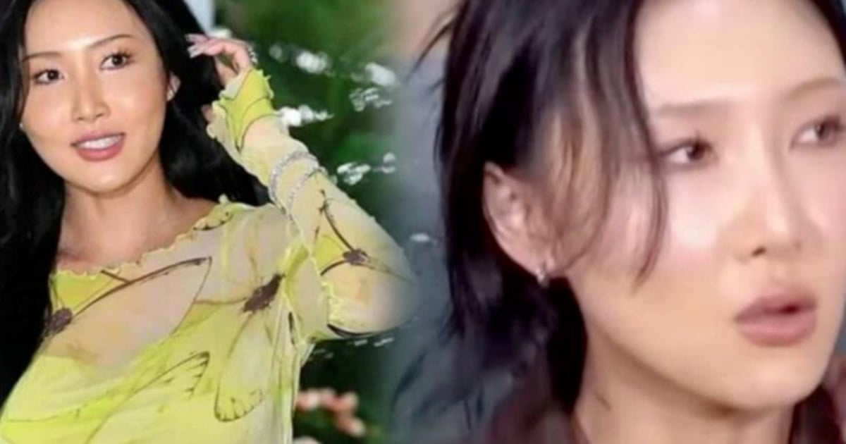 #SHOWBIZ: K-Pop star Hwasa suffers burst eardrum during recent tour