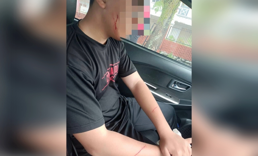 Teen slashed in attempted abduction while jogging