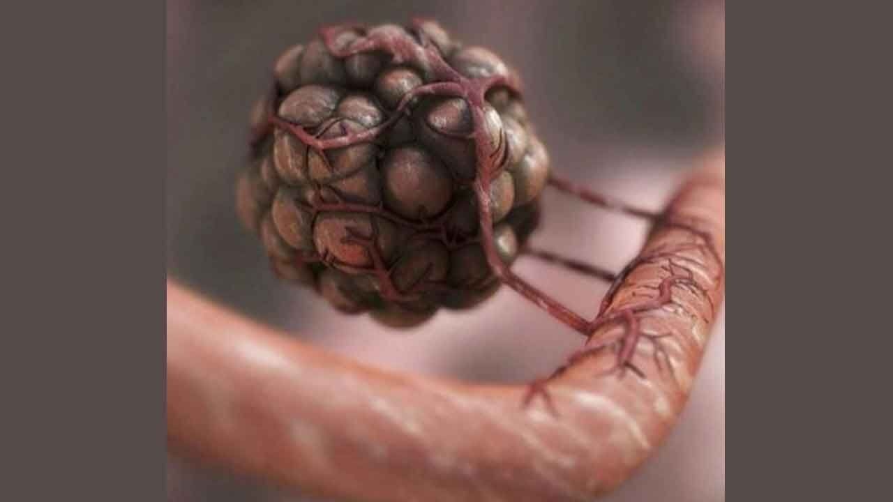 Researchers find genetic fingerprints to predict efficacy of immunotherapy
