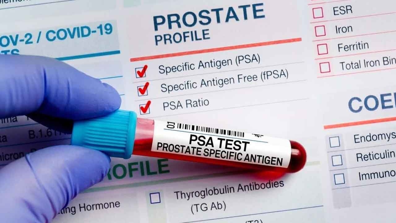 A simple PSA blood test cannot reveal prostate cancer