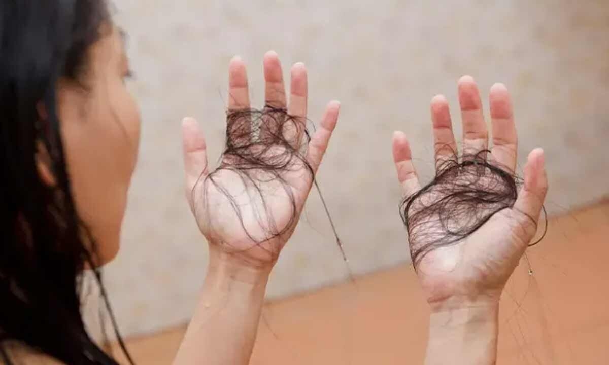 Effective Home Remedies to Control Monsoon Hair Fall Naturally