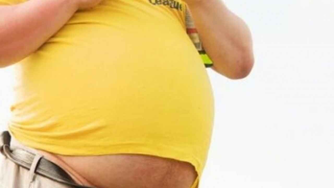 Proposed new criteria to impact obesity prevalence, say researchers