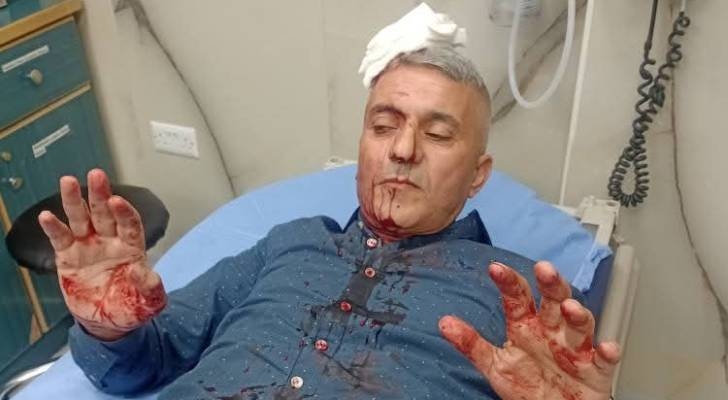 الصحفي فارس الحباشنة يتعرض لاعتداء من قبل مجموعة أشخاص في عمّان