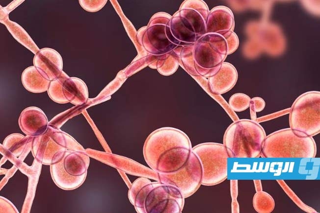 «ألبيومين الدم».. الوجه الخفي لتحول عدوى الخميرة إلى قاتل صامت