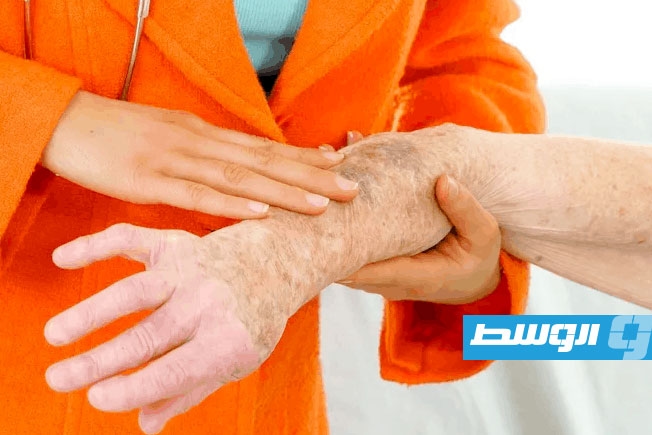 باحثون يكشفون إمكان استخدام «خلايا زومبي» في علاج السرطان