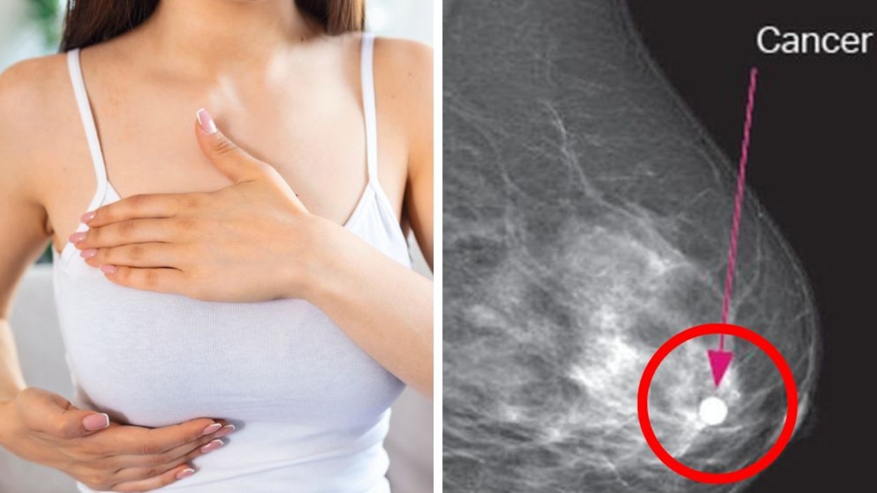 Do larger breasts increase breast cancer risk? What experts really say