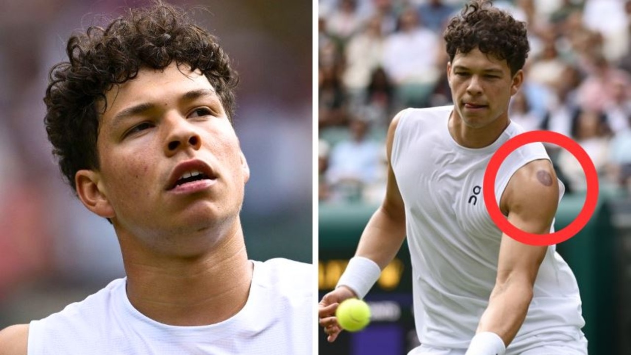 Fans stunned by large red marks on American tennis star Ben Shelton at Wimbledon