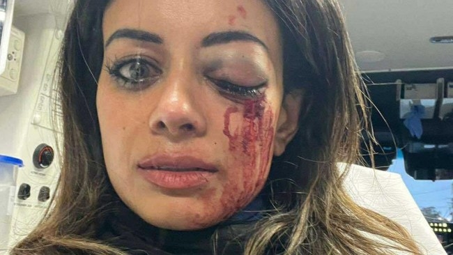 Home Affairs Minister Tony Burke warns ‘no one is above the law' after former Greens candidate injured at protest