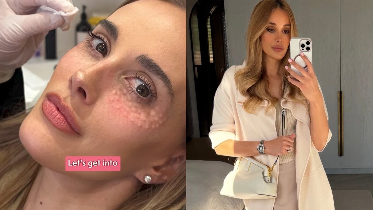 'I didn't wake up like this': AFL WAG and model Rebecca Judd lays bare the beauty treatments she's had done in candid new podcast