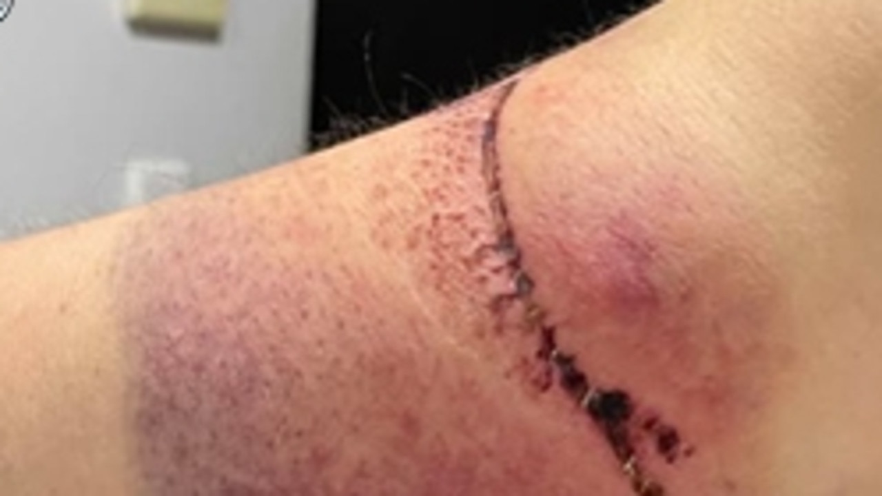 WA Police seek information after deadly trap set on Jarrahdale bush track