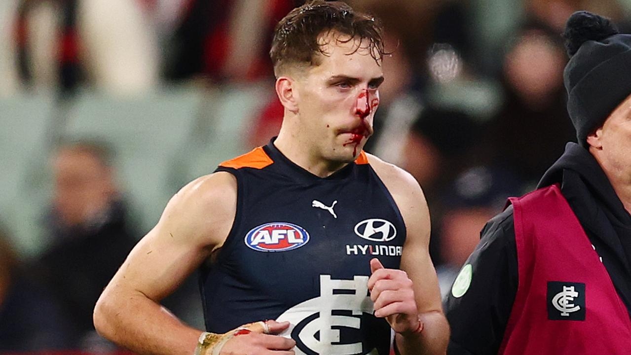 Confused players starting to hesitate in games knowing they could be banned for accidents