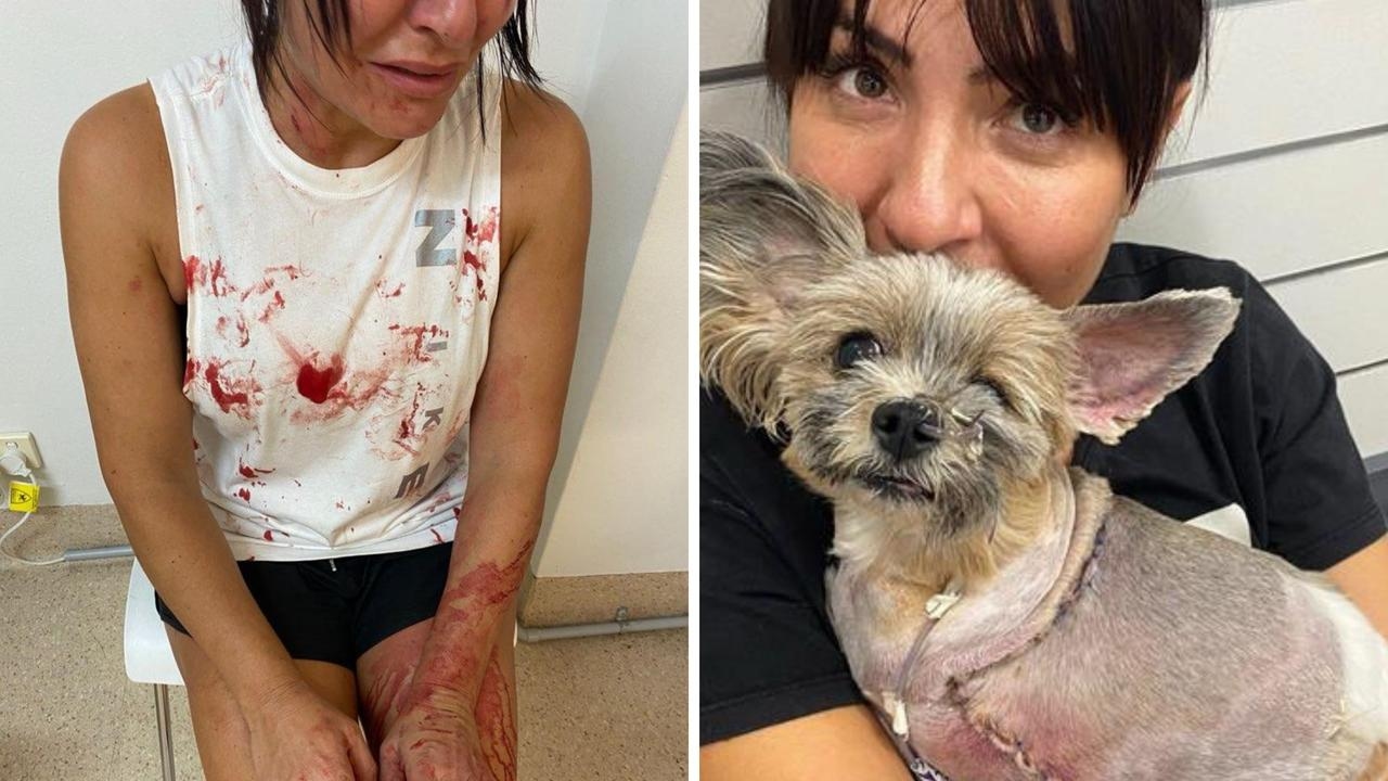 Photos reveal bloody aftermath of $100k Sydney staffy attack