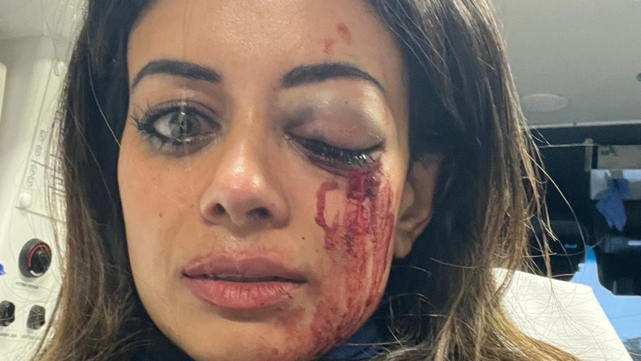 Charge dropped after Greens candidate injured in protest scuffle