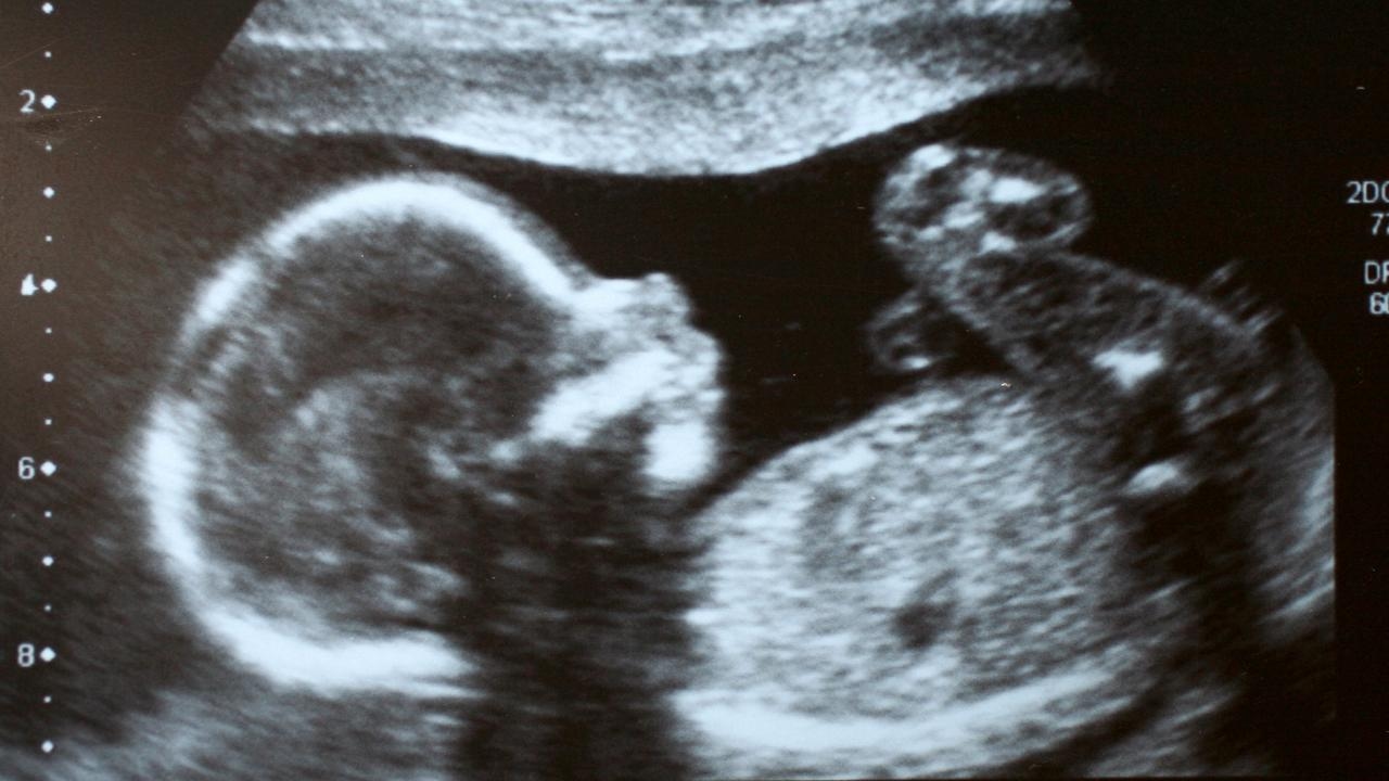 ‘Almost certainly points to human intervention': Migrant mothers giving birth to more boys than girls