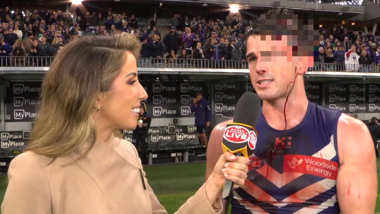 Frenzy after AFL star's classy interview following gruesome injury