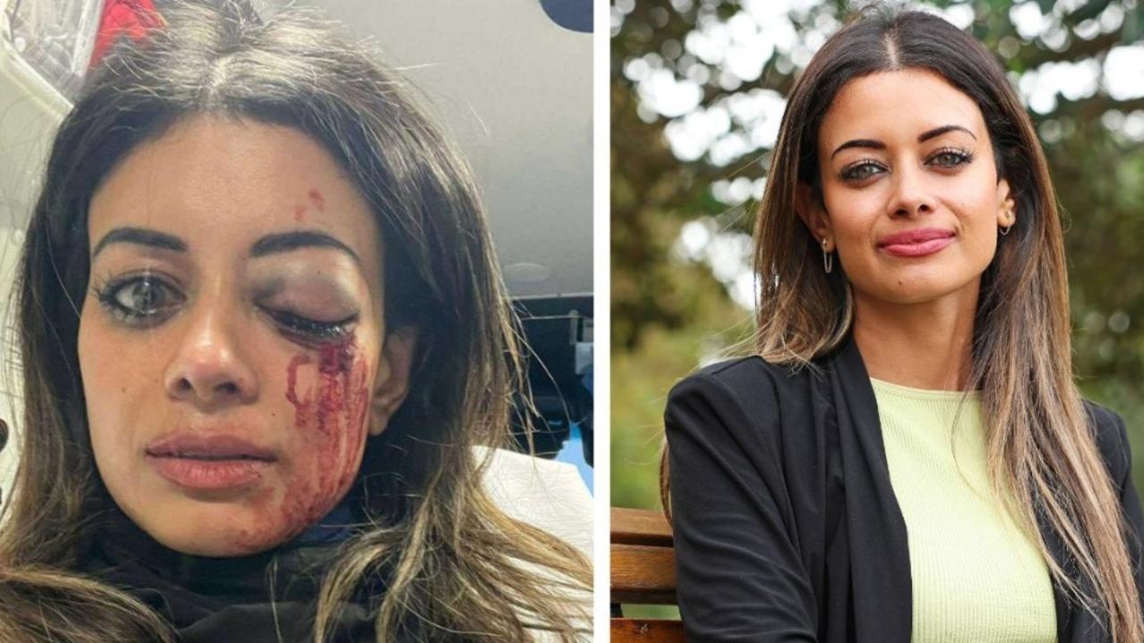 Greens candidate Hannah Thomas injured in Belmore Palestine protest