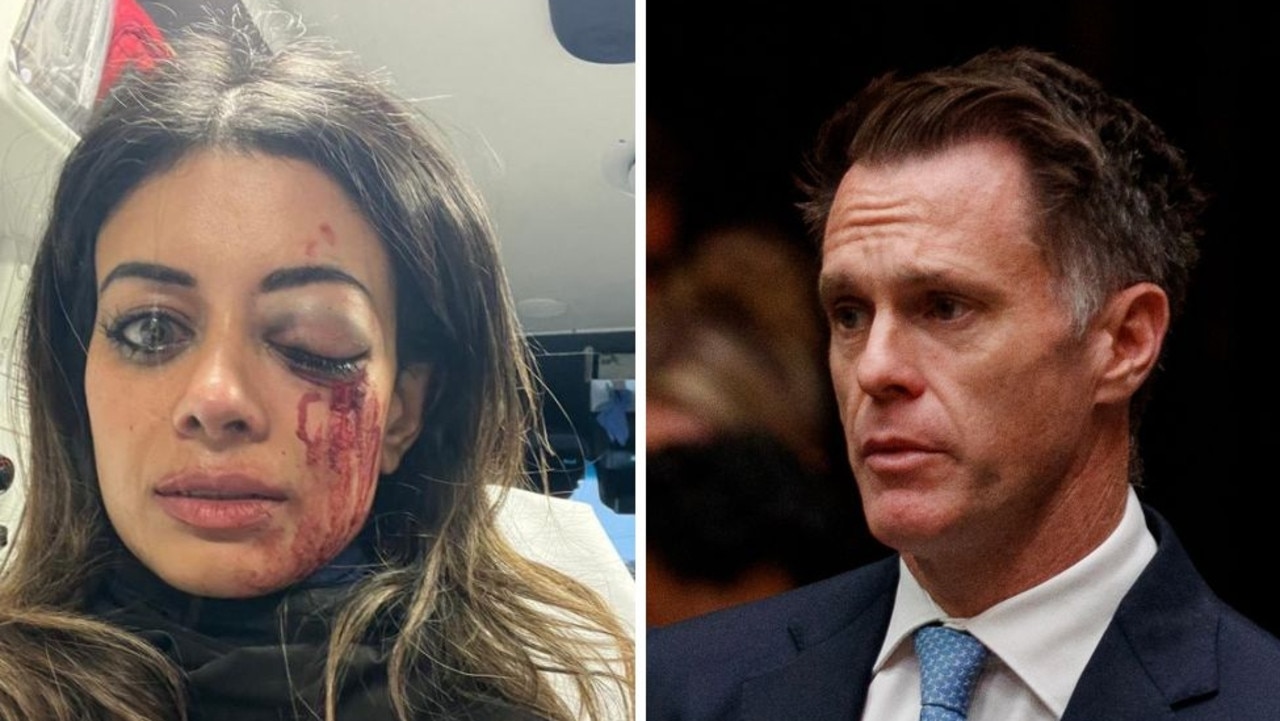‘It was punishment': MP urges Chris Minns to scrap protest laws after former Greens candidate allegedly injured in police scuffle