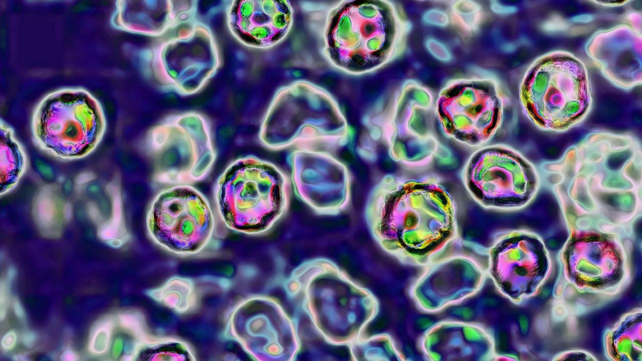 Victoria Health warns of new measles case from returned traveller who visited Pakistan