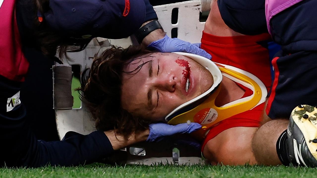 Melbourne star knocked out cold by North ruckman in scary scenes