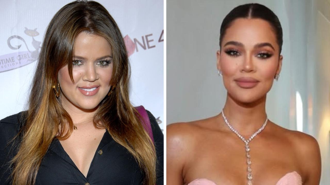 Khloe Kardashian breaks down every cosmetic procedure and surgery she's had done