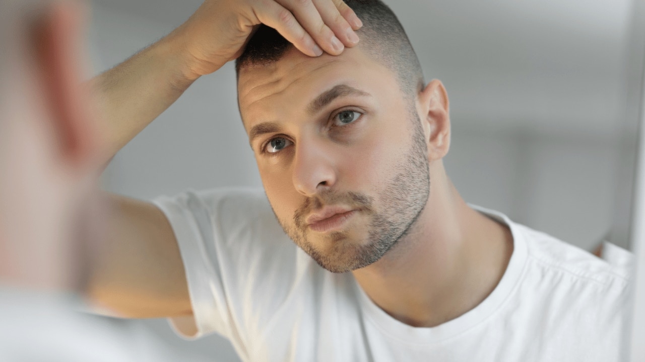 Scientists may have discovered a cure for baldness – but there's a catch