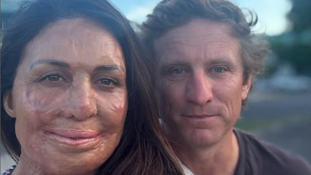 'I've got some news': Inspirational Aussie Turia Pitt unveils bold new book Selfish, calling it the book she 'wishes' she had during her darkest days