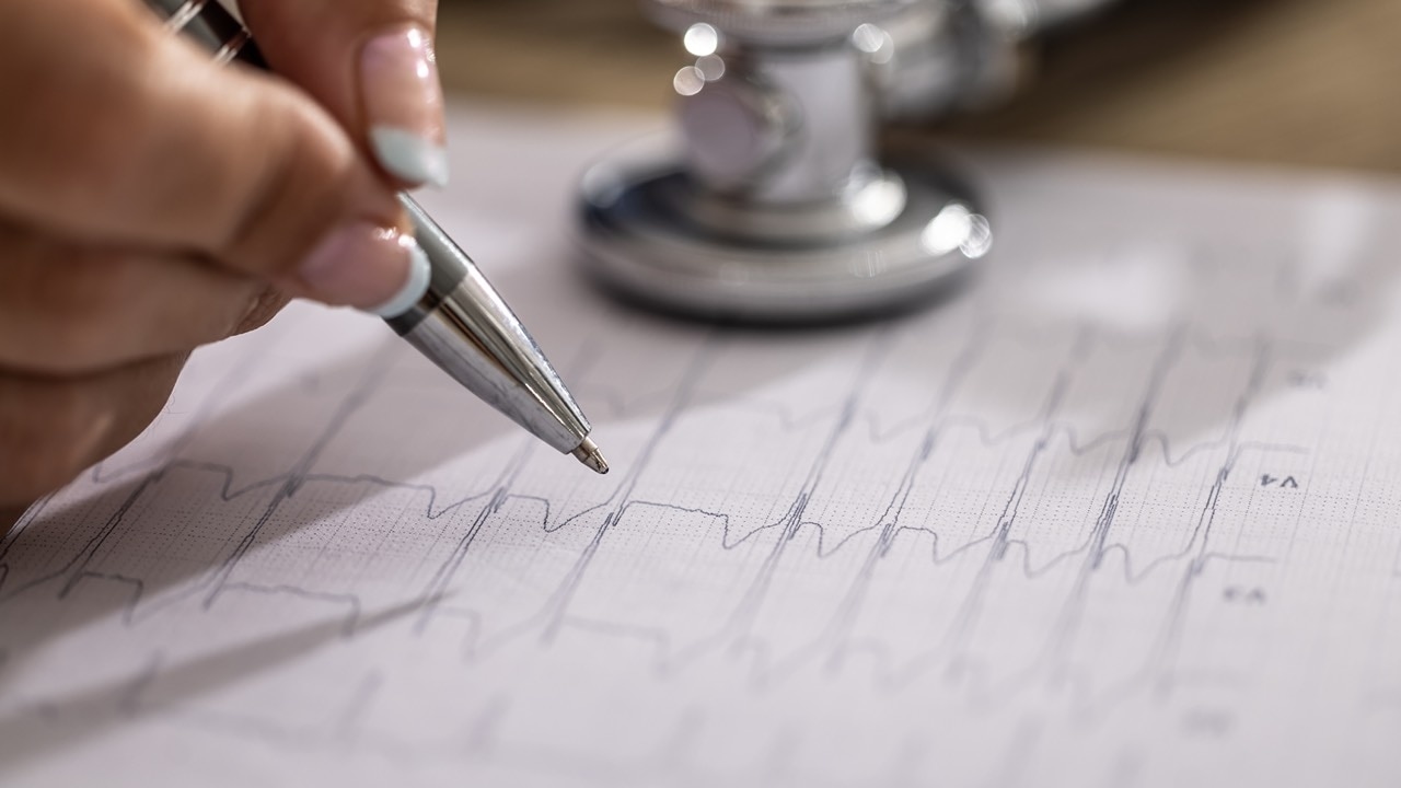 EchoSolv enters Mayo's test zone as it chases FDA approval