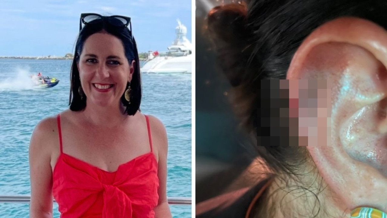 Mum's ‘pimple' led to terrifying ordeal
