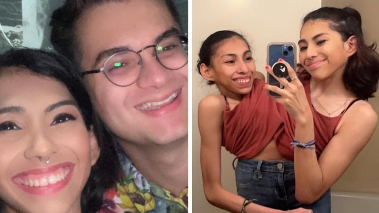 Conjoined twin influencer Carmen Andrade reveals she quietly married boyfriend Daniel McCormack