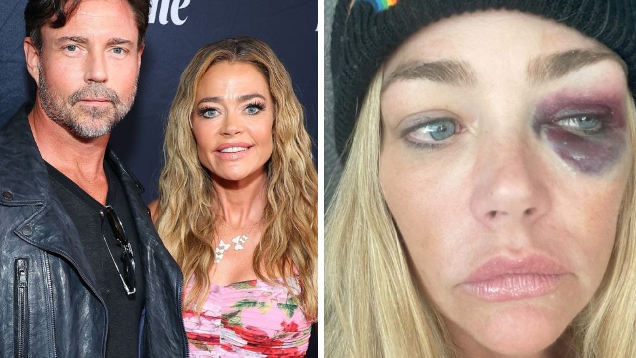 Aaron Phypers accuses Denise Richards of Vicodin addiction, having ‘ongoing' affair in explosive letter