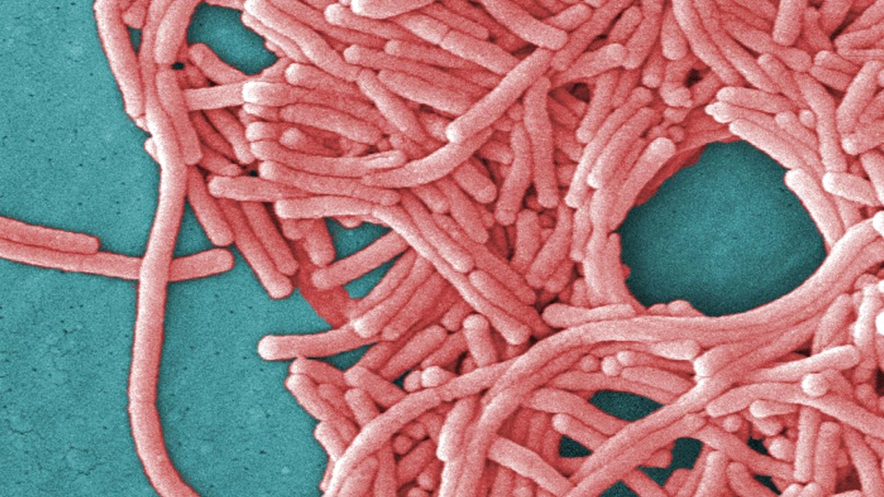 Urgent health warning after three people contract legionnaires' disease in Potts Point, Sydney