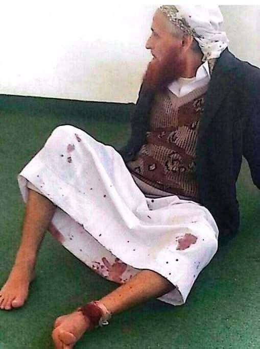 مسلحون يقتحمون مسجدا ويطلقون النار على الامام ويصبونه في ذمار