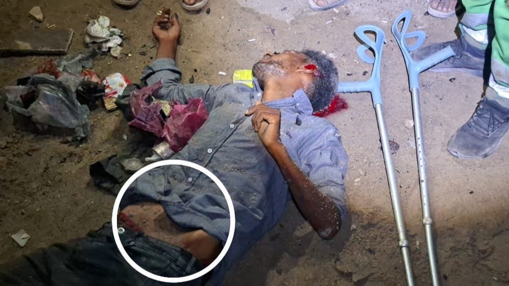 Dozens of Displaced People Killed, Injured in Shati' Camp Bombing