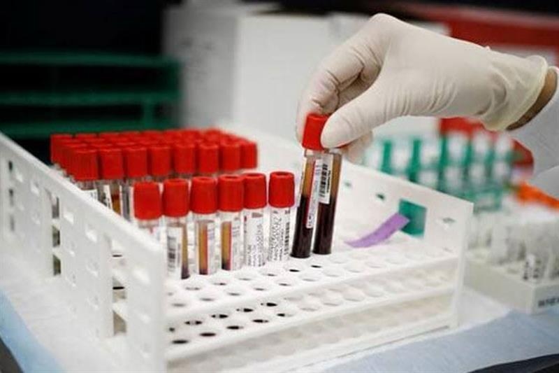 French scientists discover new blood type in Guadeloupe woman - Health - Life & Style