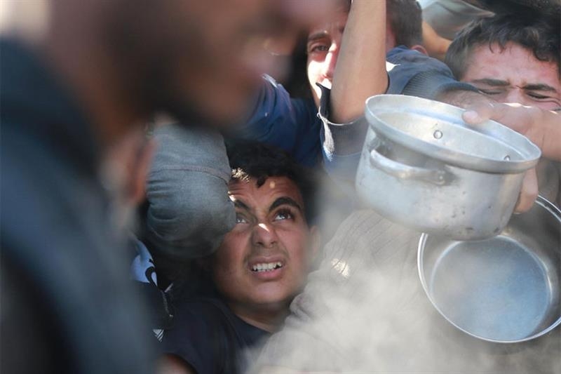 UNRWA says some Gaza staff starving as malnutrition soars - War on Gaza