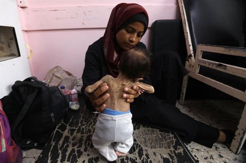 Major media say Gaza staff face starvation as 40 Palestinians died from malnutrition in July - War on Gaza