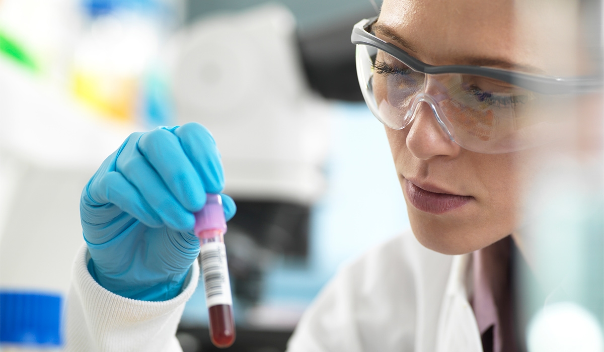 Blood test can tell if you're at risk of severe Alzheimer's