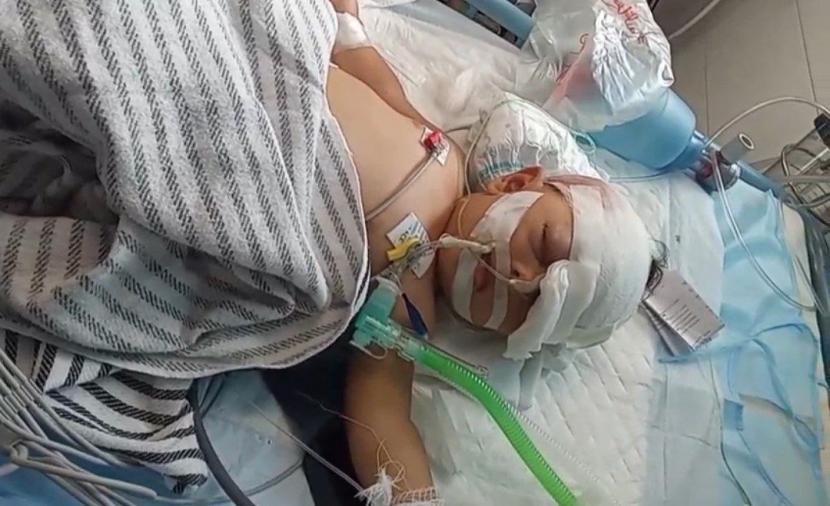 طفلان معاقان وأم حامل جريحة.. مأساة أسرة الجعب التي تنتظر الرحمة