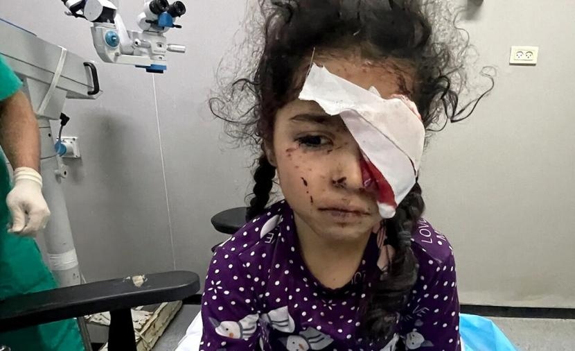 وزارة الصحة بغزة تفتح باب التسجيل للمتضررين من فقدان البصر جراء الحرب