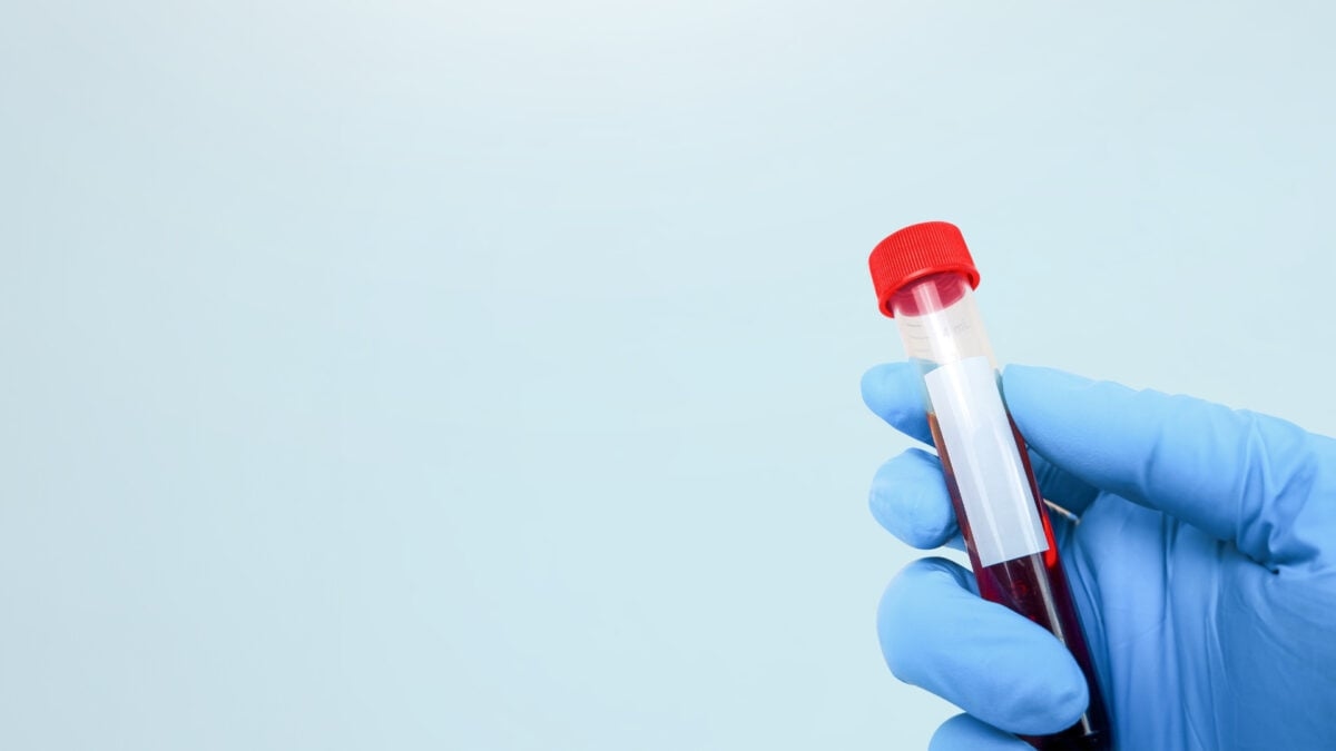 Scientists Just Found a New, Incredibly Rare Blood Type