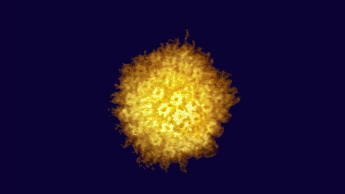 The Next Big Cancer Treatment Could Be Herpes